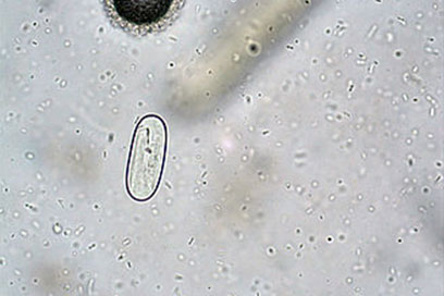 Spirocerca lupi - the worm you did not know about